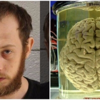 Next article: Pennsylvania man steals human brain, uses it to get high