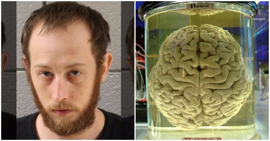 Pennsylvania man steals human brain, uses it to get high